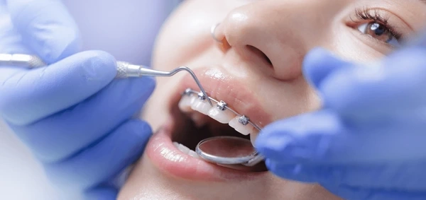 dental braces in tisdale, sk