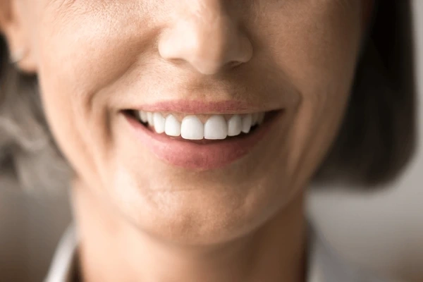 full mouth reconstruction in tisdale, sk
