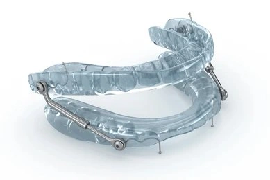 sleep oral appliances in tisdale, sk