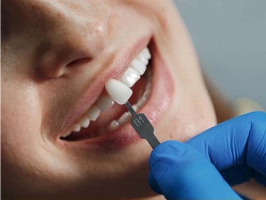 implant restorations tisdale, sk